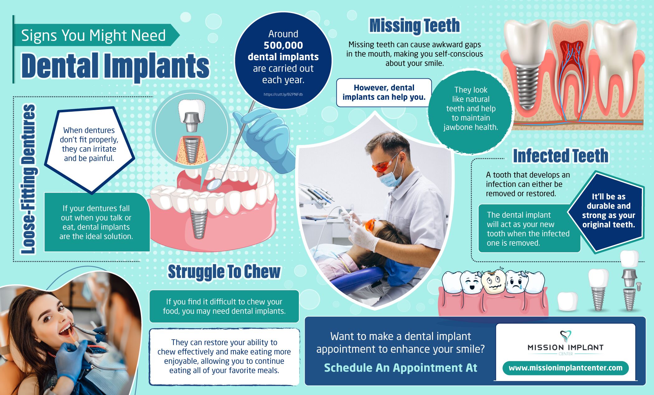 Dental Implants