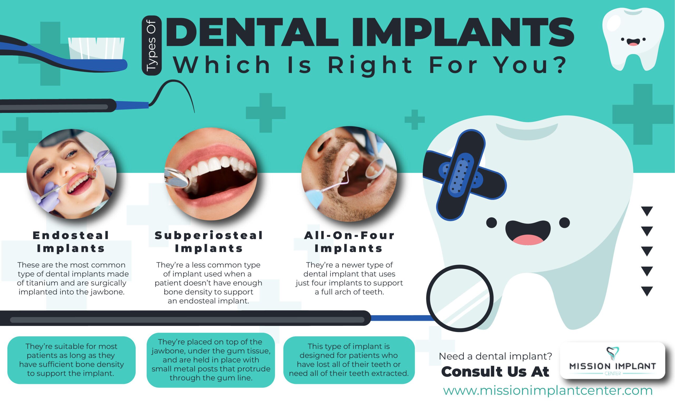 dental implants